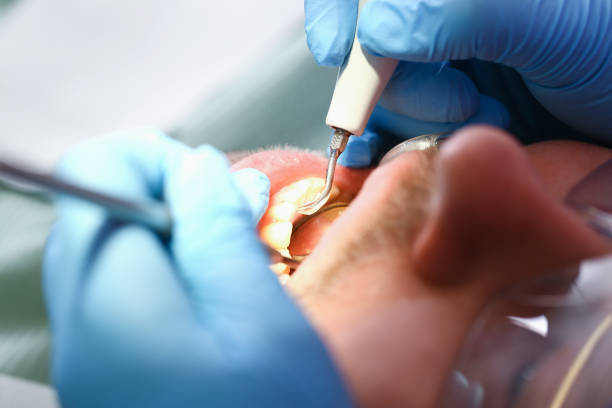Best Emergency Orthodontic Repairs in Rancho Santa Margarita, CA